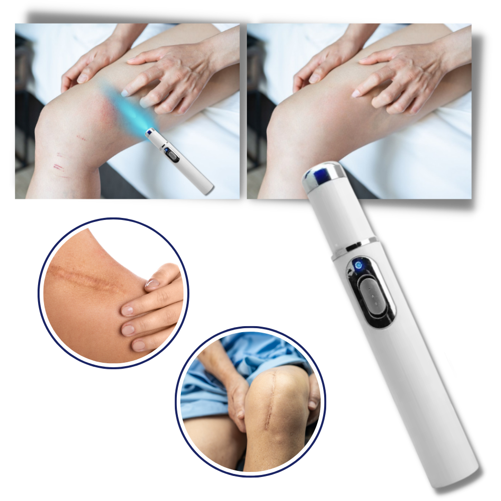 DermaPure | Portable Laser Therapy for a Brighter Complexion