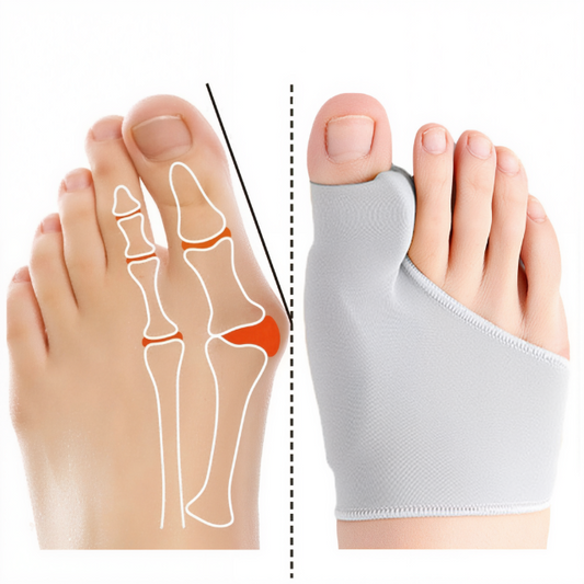 Glevato | Bunion Corrector Gel Pad Support