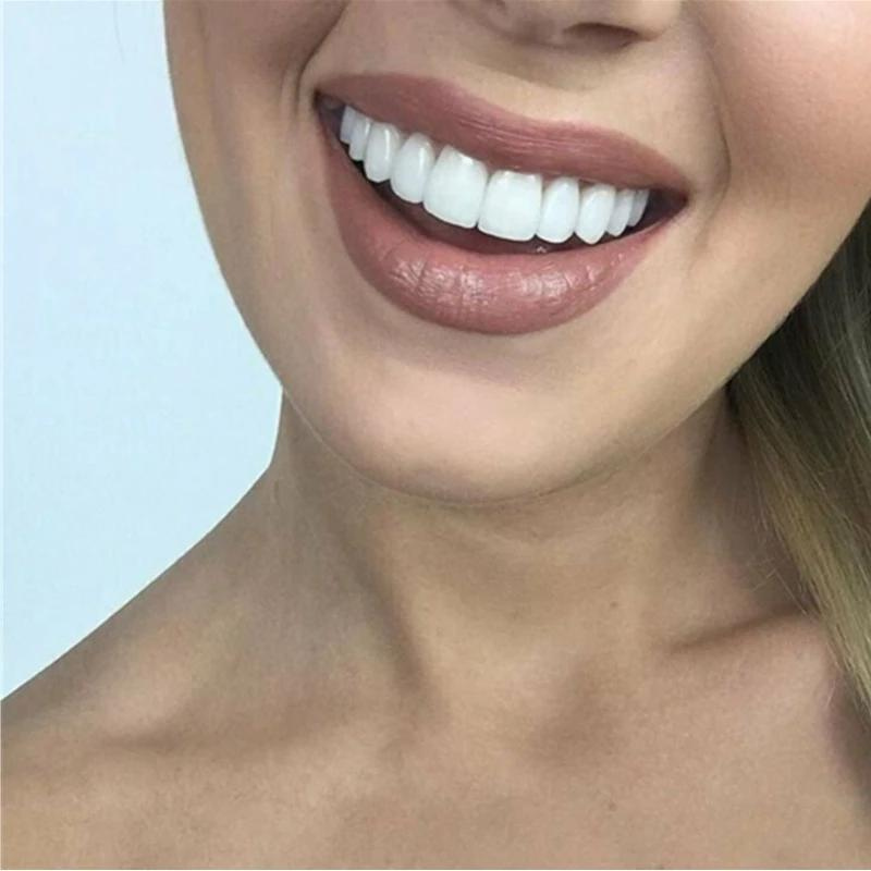 Glevato | Cosmetic Smile Veneers Snap-On Smile Dental Cover