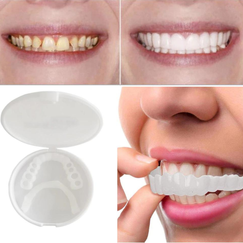 Glevato | Cosmetic Smile Veneers Snap-On Smile Dental Cover