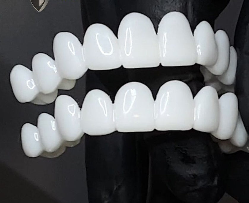 Glevato | DentAlign Dental Veneers – Natural Fit and Comfort