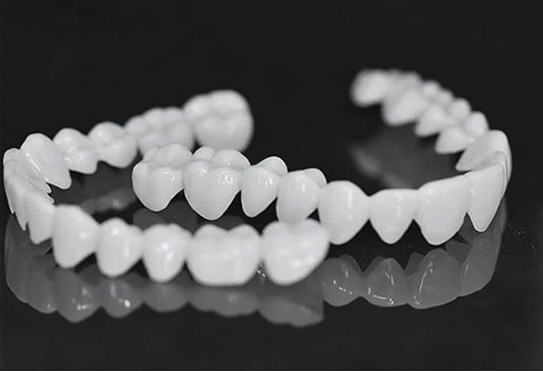 Glevato | DentAlign Dental Veneers – Natural Fit and Comfort