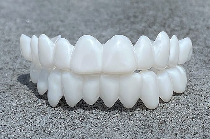 Glevato | DentAlign Dental Veneers – Natural Fit and Comfort