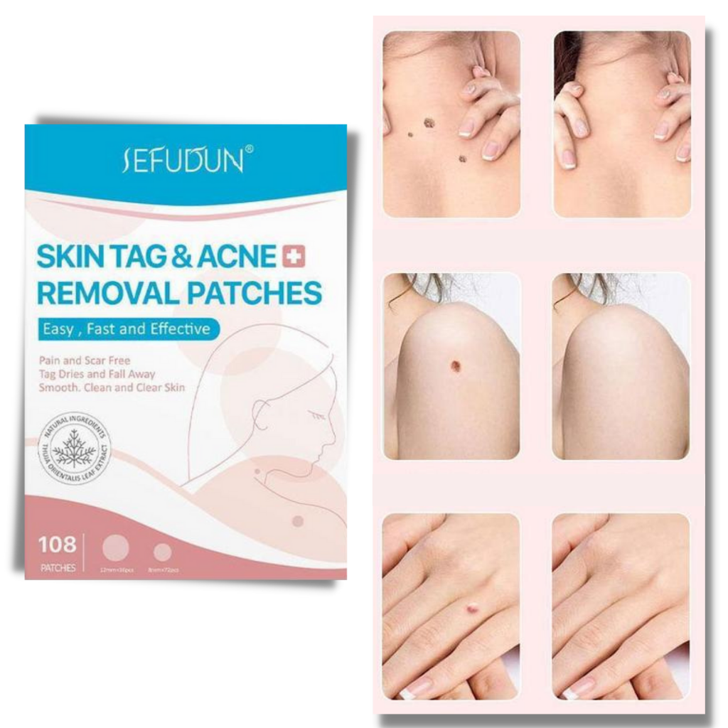 Glevato | Skin Patch - Remove Moles and Warts Naturally!