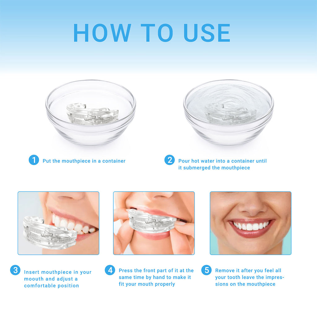 SilentForm Anti-Snoring Device – Adjustable, Optimized Comfort, Effective Solution for Sleep