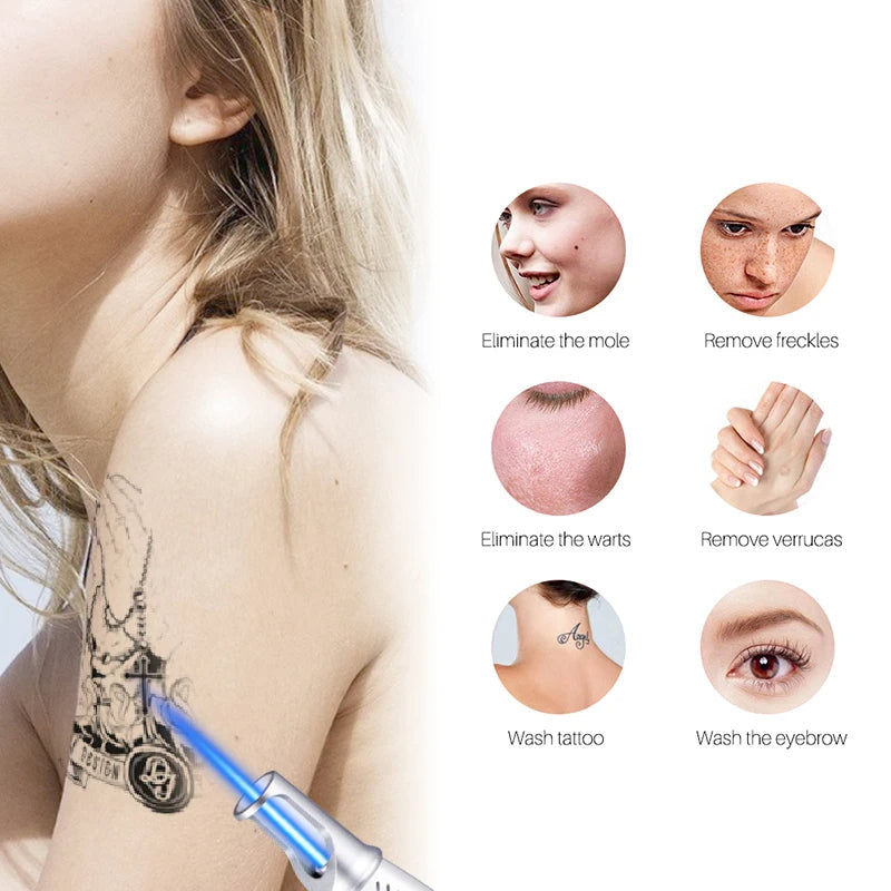 Smart Tattoo Removal Laser Pen - Remove Birthmarks, Freckles, Acne, Tattoo