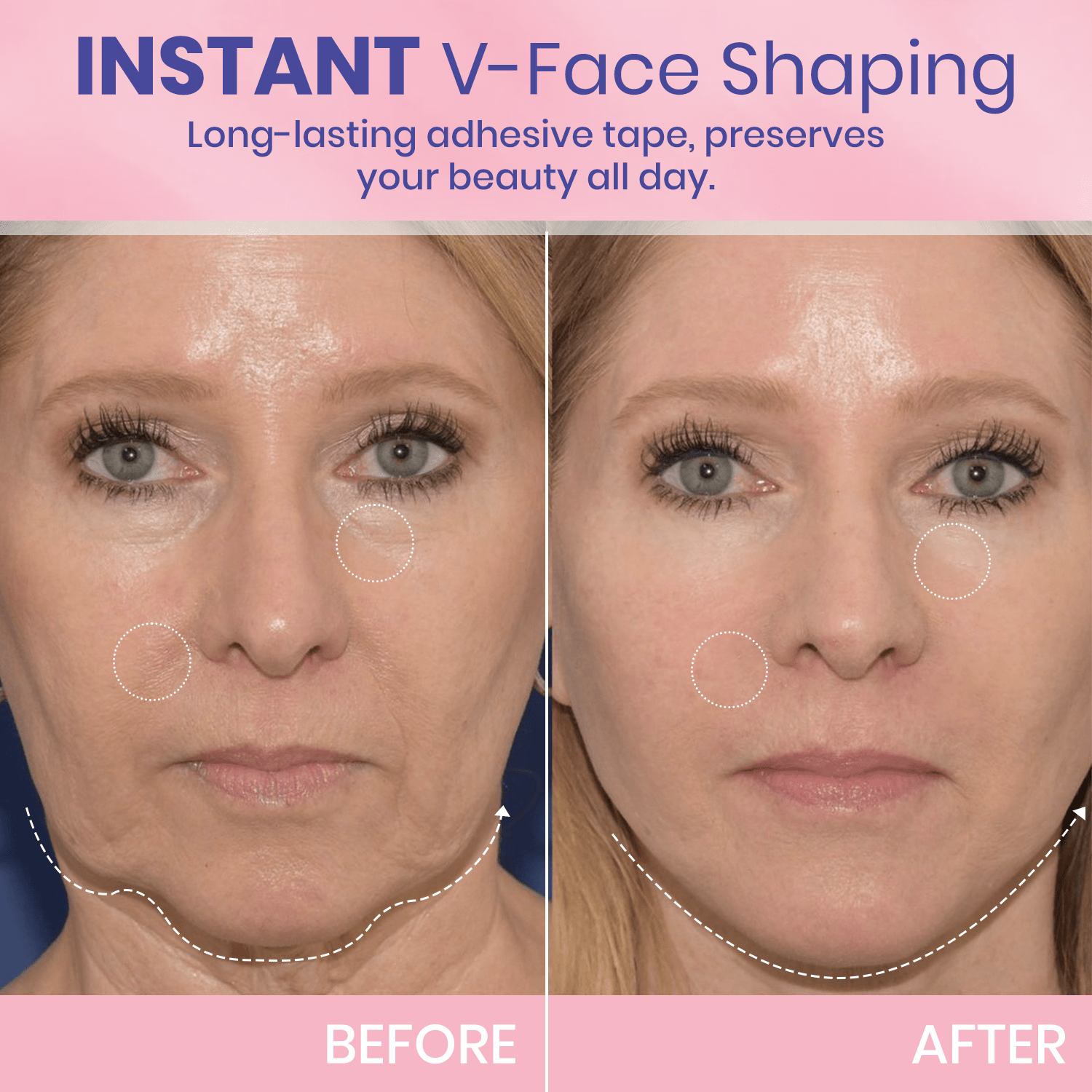 V Face-Lifting Invisible Tape